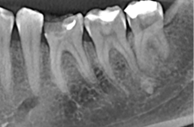 Рентгенологическое исследование зубов